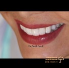 دندانپزشک زيبایی مشهد دكتر فاضلی