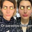 face-modeling