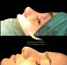 nose-job-after-surgery-ahvaz