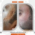face-beauty-before-after