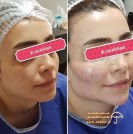 beauty-doctor-clinic-sanandaj-zarafshani